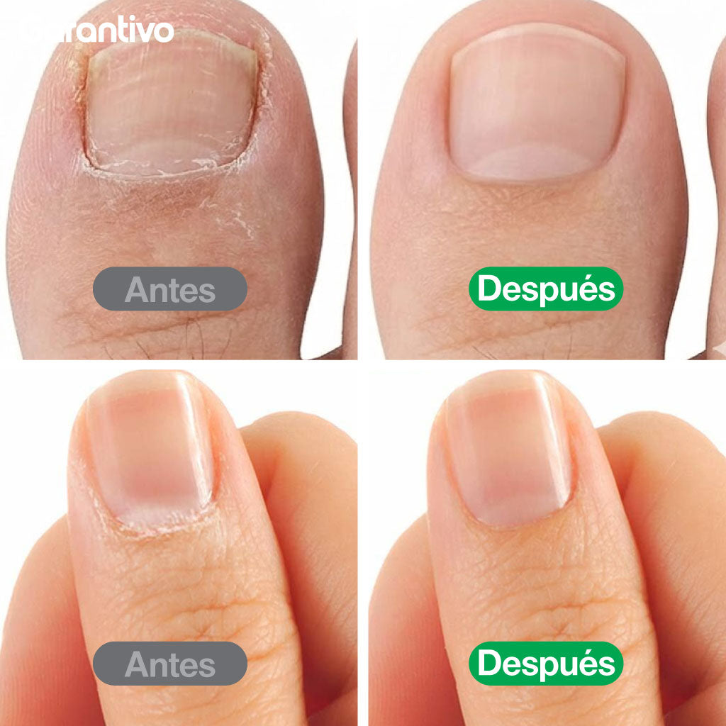 Kit profesional de manicura y pedicura para cuidado completo