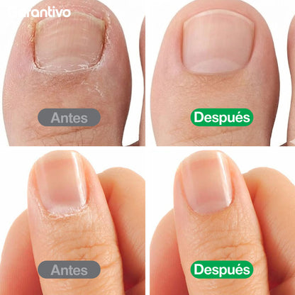 Kit profesional de manicura y pedicura para cuidado completo