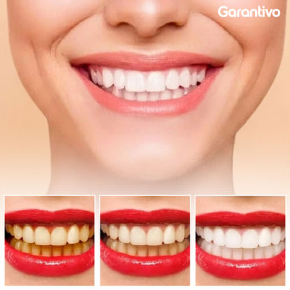 Esencia blanqueadora para dientes y limpieza profunda