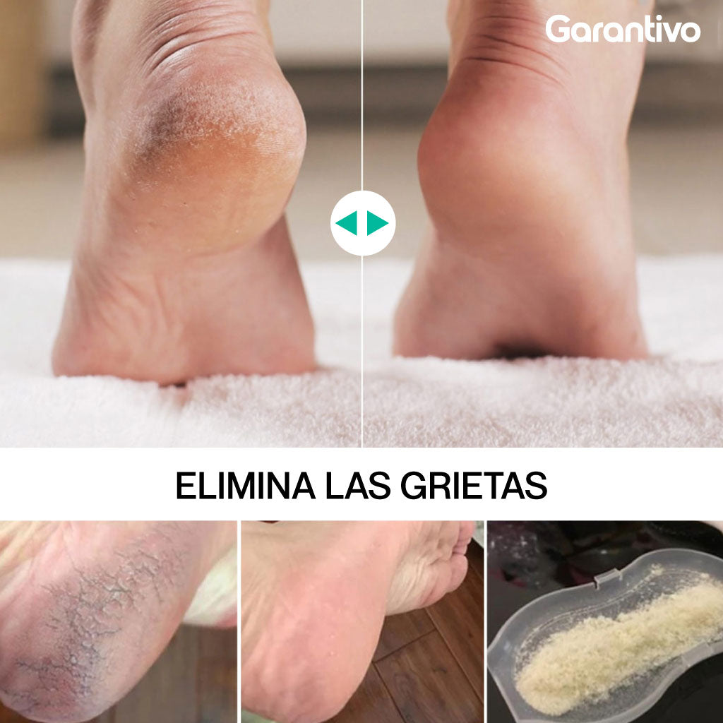 Lima eléctrica recargable para pies y eliminación de callos