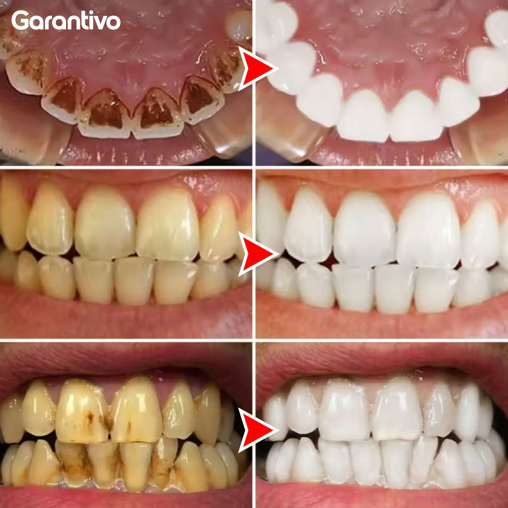Esencia blanqueadora para dientes y limpieza profunda